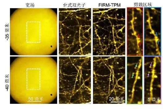 超快光纖激光助力微型雙光子顯微成像系統研究